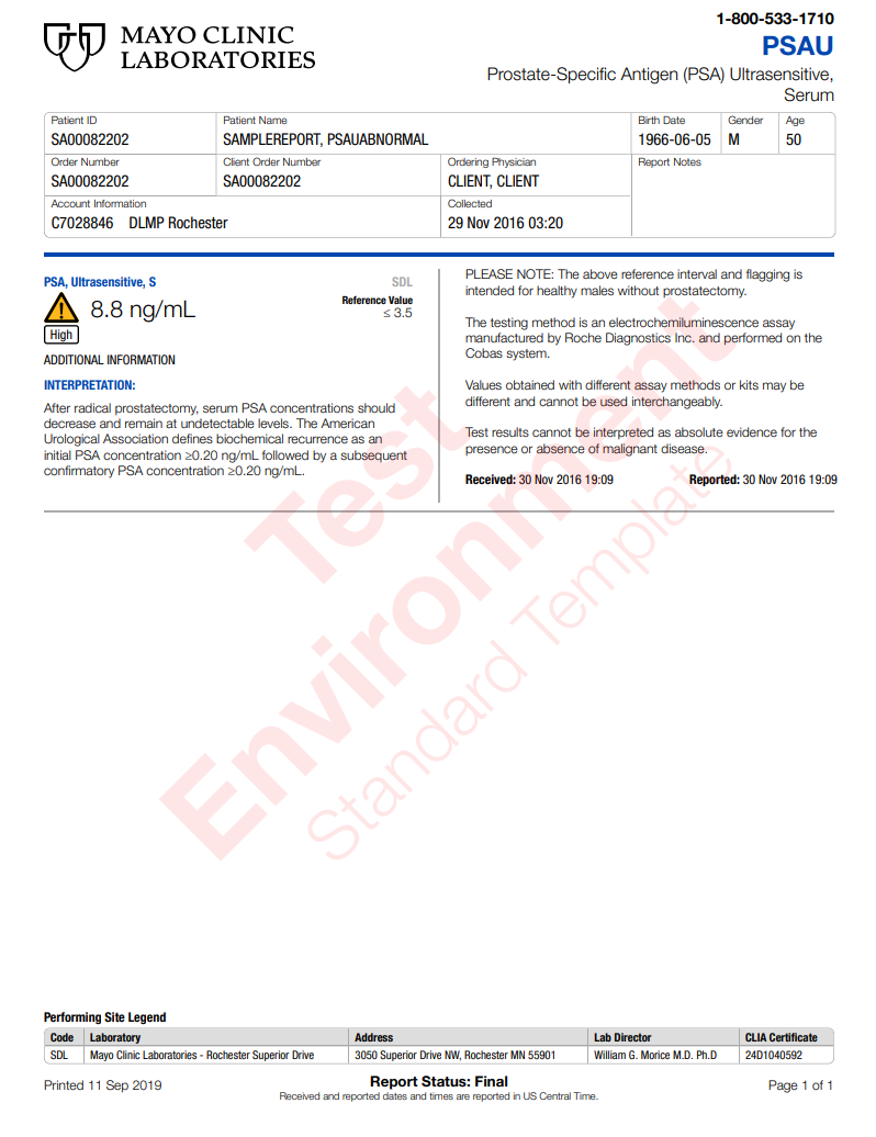Prostate Specific Antigen Ultra Sensitive